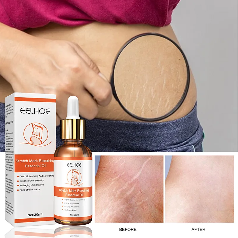 Maternity Scar Repair Essential Oil Pregnancy Lift Stretch Mark Remove Enhance Skin Care Elasticity Firm Sagging Deep Moisturize Maternity Scar Repair Essential Oil Pregnancy Lift Stretch Mark Remove Enhance Skin Care Elasticity Firm Sagging Deep Moisturize