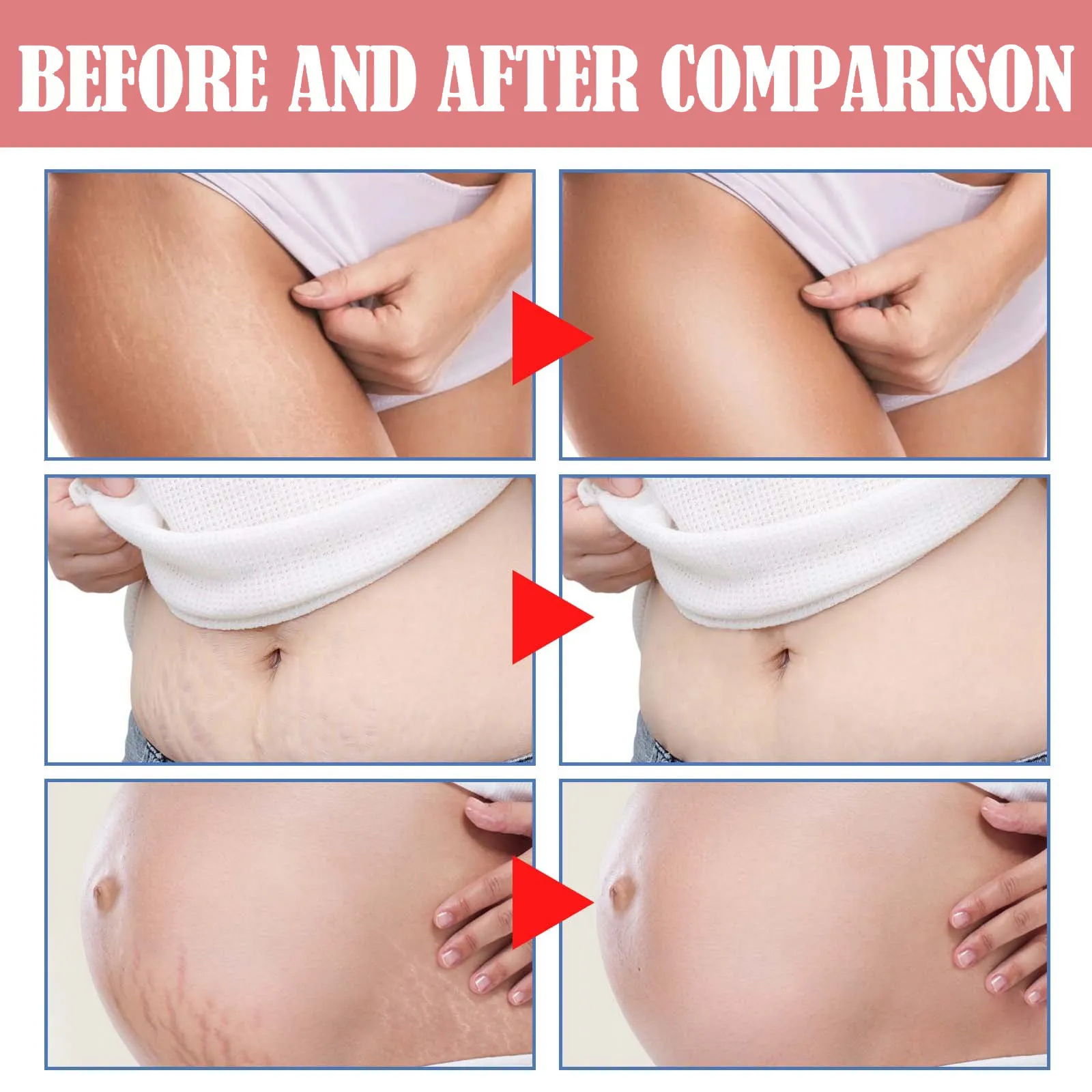 Maternity Scar Repair Essential Oil Pregnancy Lift Stretch Mark Remove Enhance Skin Care Elasticity Firm Sagging Deep Moisturize Maternity Scar Repair Essential Oil Pregnancy Lift Stretch Mark Remove Enhance Skin Care Elasticity Firm Sagging Deep Moisturize