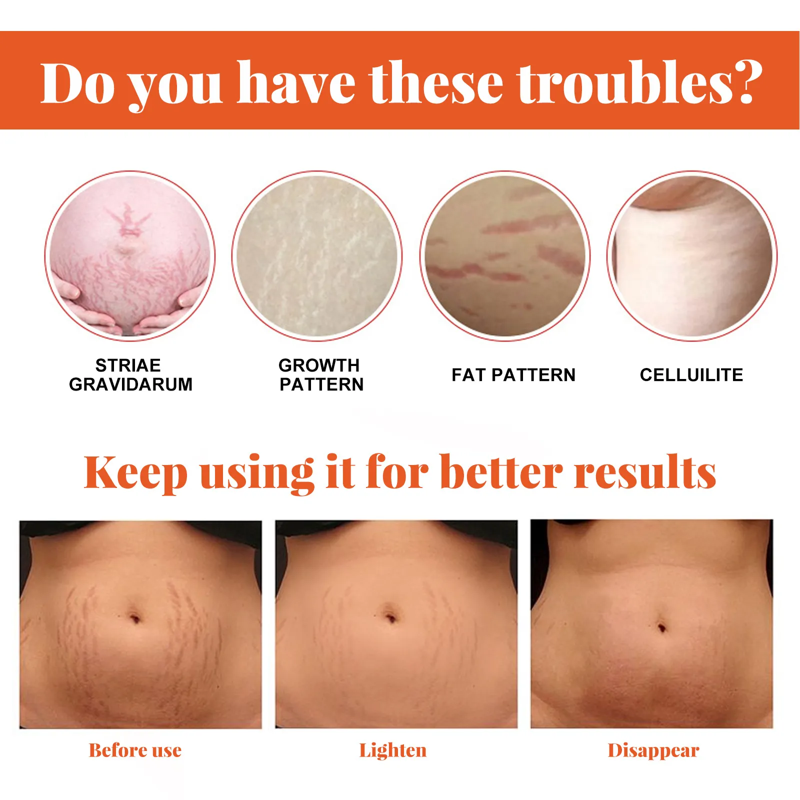 Maternity Scar Repair Essential Oil Pregnancy Lift Stretch Mark Remove Enhance Skin Care Elasticity Firm Sagging Deep Moisturize Maternity Scar Repair Essential Oil Pregnancy Lift Stretch Mark Remove Enhance Skin Care Elasticity Firm Sagging Deep Moisturize