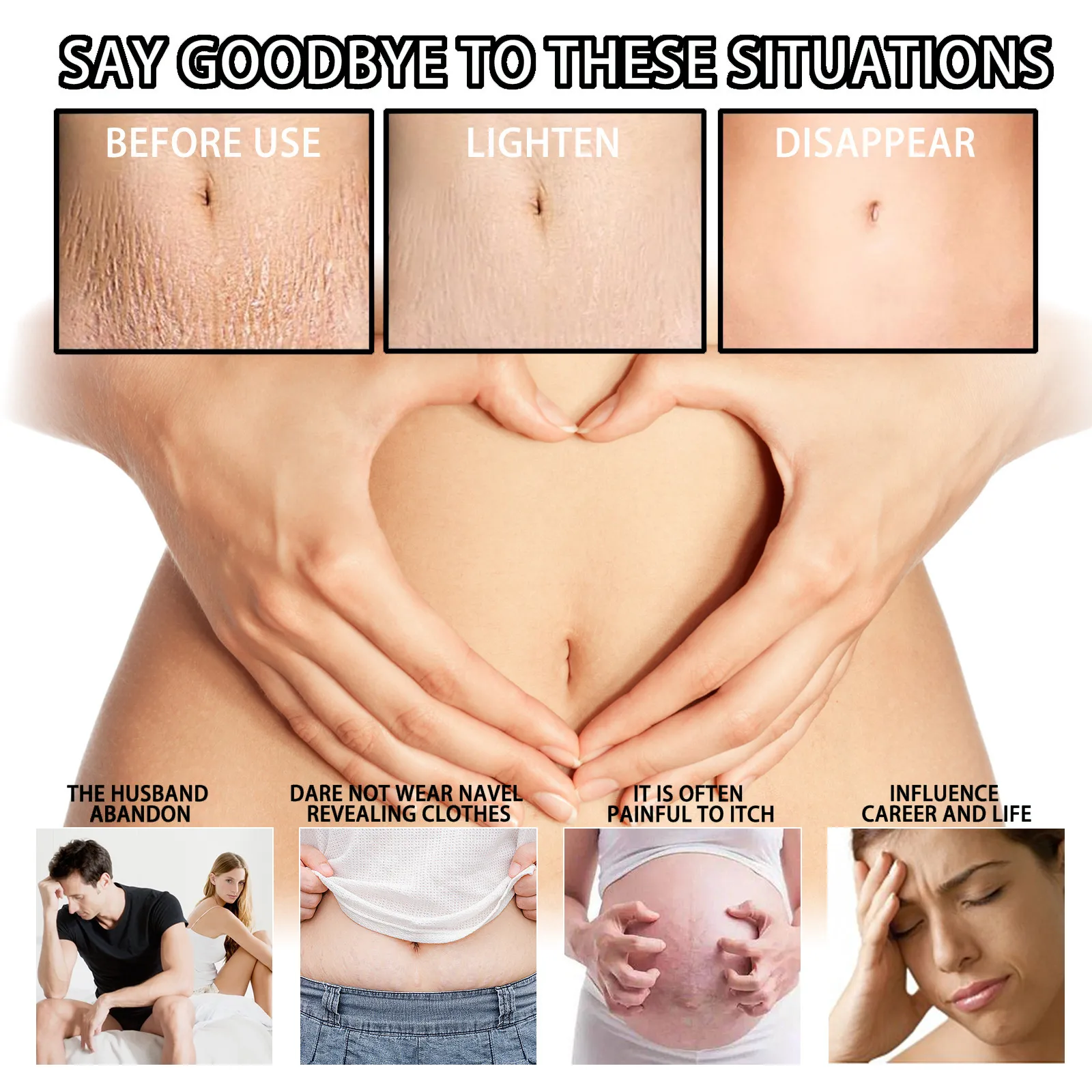 Maternity Scar Repair Essential Oil Pregnancy Lift Stretch Mark Remove Enhance Skin Care Elasticity Firm Sagging Deep Moisturize Maternity Scar Repair Essential Oil Pregnancy Lift Stretch Mark Remove Enhance Skin Care Elasticity Firm Sagging Deep Moisturize